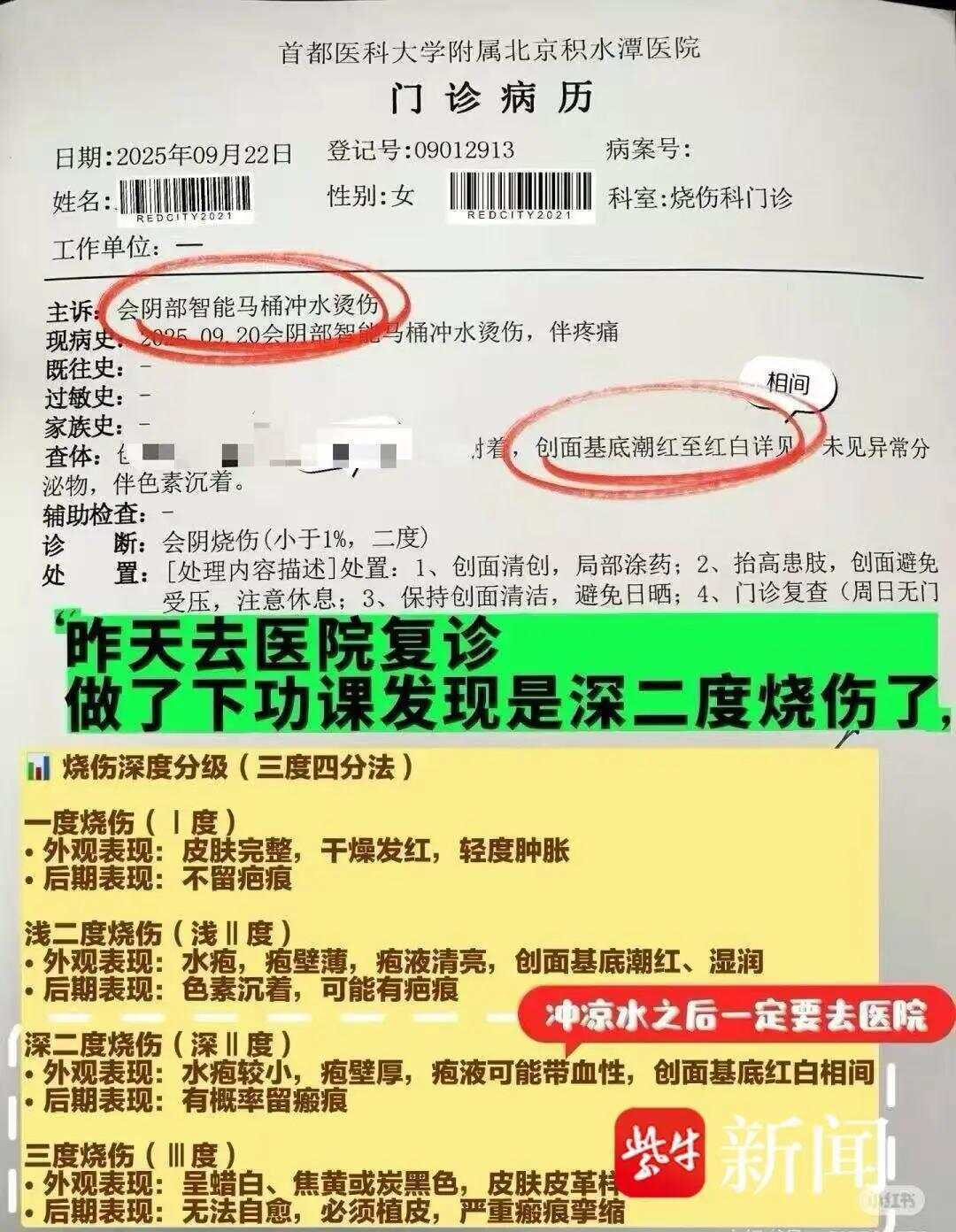 皇冠信用网申请_女子上厕所被烫到尖叫弹起!用了3年的智能马桶突然卡顿皇冠信用网申请,下一秒喷冒烟开水,被烫后冲1小时冷水仍二度烧伤
